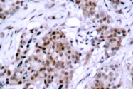 AP06111PU-N - Estrogen receptor alpha