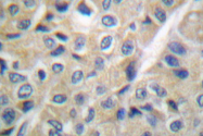 AP06121PU-N - FHIT