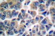 AP06123PU-N - Filamin-A