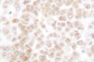 AP06126PU-N - Fos-related antigen 2