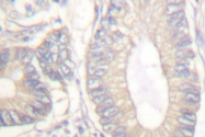 AP06134PU-N - Gastrin
