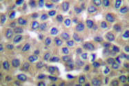 AP06150PU-N - Endoplasmin / HSP90B1 / TRA1