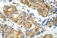 AP06151PU-N - GSK3 alpha