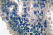 AP06153PU-N - Guanylate cyclase soluble GUCY1B3