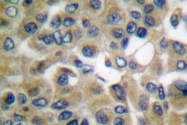 AP06154PU-N - Chorionic Gonadotropin (hCG)