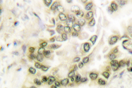 AP06155PU-N - HDAC1