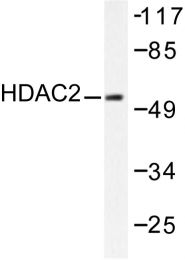 AP06157PU-N - HDAC2