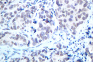AP06157PU-N - HDAC2