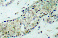 AP06159PU-N - HDAC5