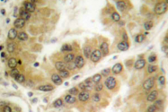 AP06161PU-N - HDAC7