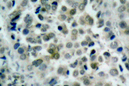 AP06162PU-N - HDAC8