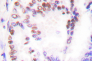 AP06163PU-N - HDAC9