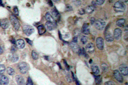 AP06172PU-N - HSPB1 / HSP27