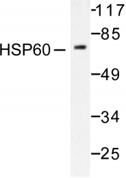 AP06174PU-N - HSP60