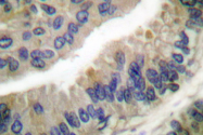 AP06175PU-N - HSP90AA1 / HSP90 alpha
