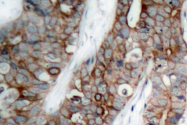 AP06182PU-N - CD61 / ITGB3