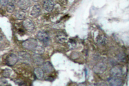 AP06185PU-N - NFKBIA / IKBA