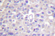 AP06189PU-N - Tyrosine-protein kinase JAK2
