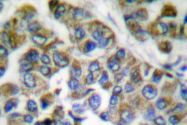 AP06195PU-N - Cytokeratin 14