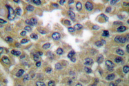AP06198PU-N - Cytokeratin 17