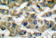 AP06200PU-N - Cytokeratin 18