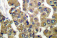 AP06203PU-N - Cytokeratin 5
