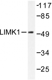 AP06209PU-N - LIMK1