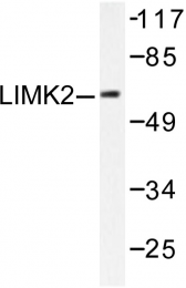 AP06211PU-N - LIMK2