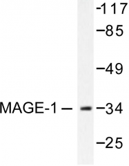 AP06212PU-N - MAGE-1
