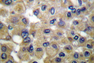 AP06213PU-N - SCGB2A1 / Mammaglobin B