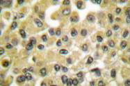 AP06215PU-N - MCL1