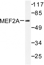 AP06219PU-N - MEF2A