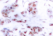 AP06219PU-N - MEF2A