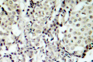 AP06222PU-N - MAP2K3