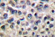 AP06227PU-N - MMP-14 / MT1-MMP
