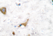 AP06229PU-N - MMP-16