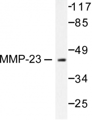 AP06232PU-N - MMP-23