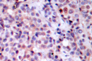 AP06248PU-N - RELA / NF-kB p65