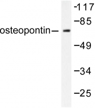 AP06258PU-N - Osteopontin / SPP1