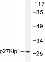 AP06264PU-N - CDKN1B / KIP1