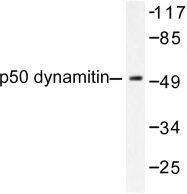 AP06265PU-N - Dynactin subunit 2