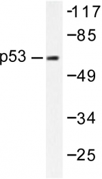 AP06269PU-N - TP53 / p53