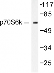 AP06272PU-N - RPS6KB1 / STK14A