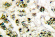 AP06281PU-N - PCNA