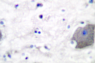 AP06290PU-N - Presenilin-1