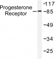 AP06291PU-N - Progesterone receptor
