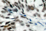AP06302PU-N - Retinoblastoma-associated protein / RB1