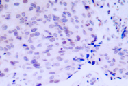 AP06304PU-N - Retinoblastoma-associated protein / RB1