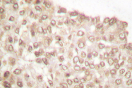 AP06305PU-N - RCBTB1