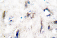 AP06315PU-N - PTPN11 / PTP2C
